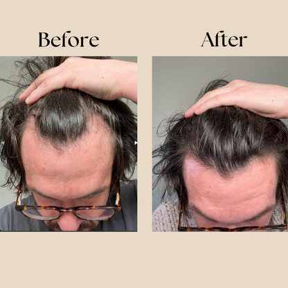 Liora Eelhoe Natural Hair Growth Oil